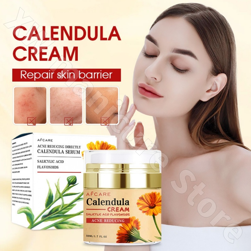 Luxury Skincare Whitening Cream - Crema riparatrice alla calendula Crema idratante